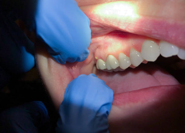 Best Same-Day Emergency Dentist in Lake Wazeecha, WI